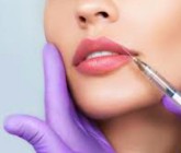 تولید مشترک هیالورونیک آسید